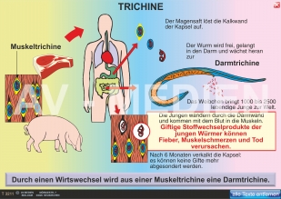 Trichine und Leberegel