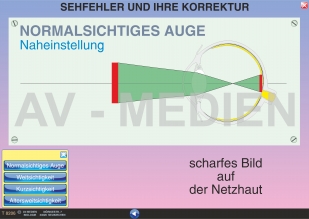 Sehfehler und ihre Korrektur