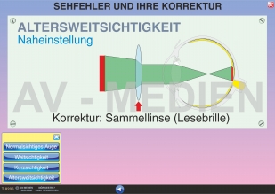 Sehfehler und ihre Korrektur