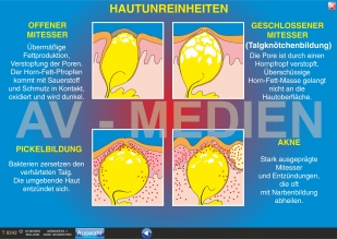 Die Haut