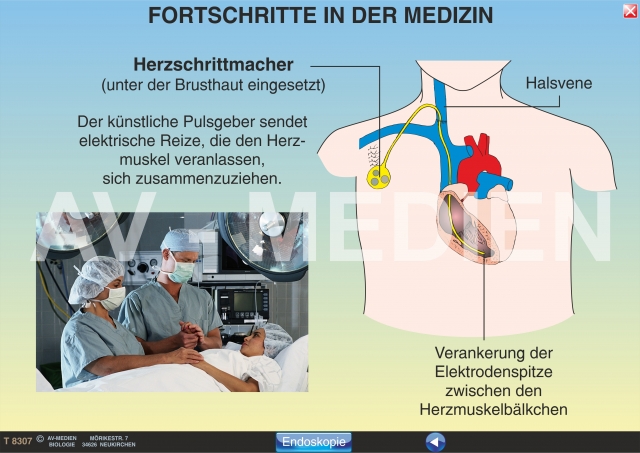 Herzinfarkt - AV-Medien Onlineshop